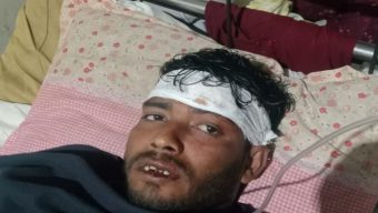 পিটিয়ে জামায়াত কর্মির দাঁত ভেঙে দিল ছাত্রলীগ