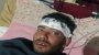 পিটিয়ে জামায়াত কর্মির দাঁত ভেঙে দিল ছাত্রলীগ