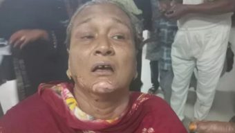 চট্টগ্রামে পেট্রোলবোমা হামলায় দগ্ধ ২