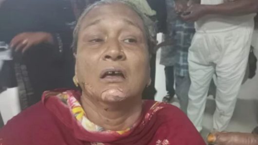 চট্টগ্রামে পেট্রোলবোমা হামলায় দগ্ধ ২