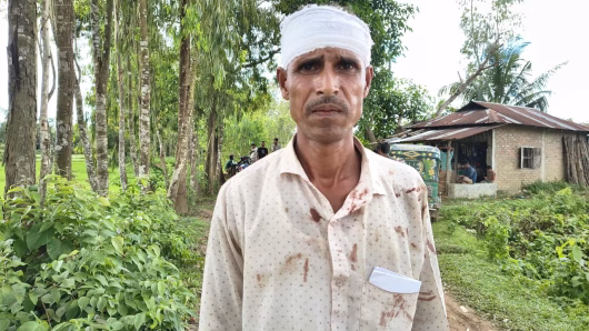 লোহাগাড়ায় শিশুকে মাদক ব্যবসায় সম্পৃক্ত করার প্রতিবাদ করায় পিতার উপর হামলা