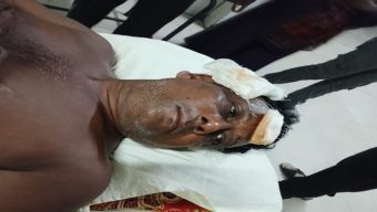 খুলনায় বিএনপি নেতাকে গুলি