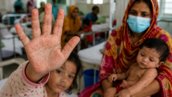 Bangladesh Measles Outbreak Death Toll Nears 1,000